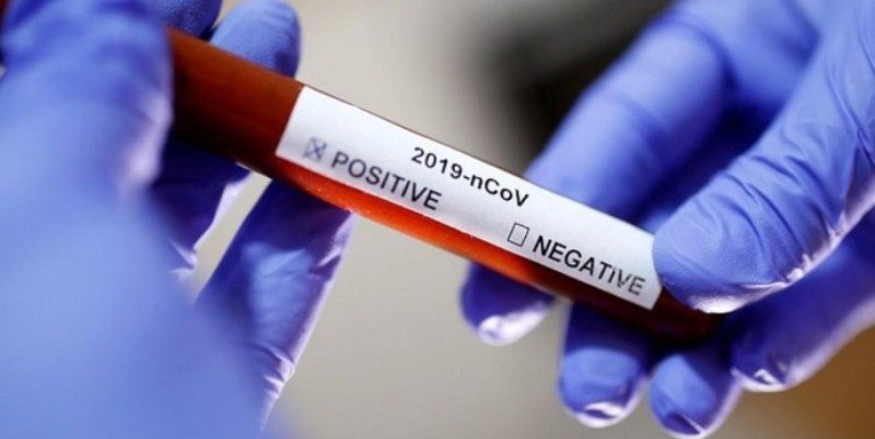 В Виннице на COVID-19 заболели мать с 10-месячным сыном В Виннице на COVID-19 заболели мать с 10-месячным сыном