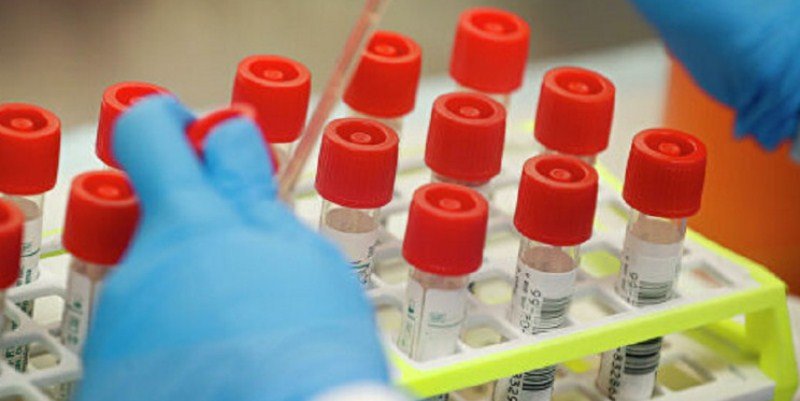 Где в Винницкой области за сутки подтвердили новые случаи коронавируса Где в Винницкой области за сутки подтвердили новые случаи коронавируса